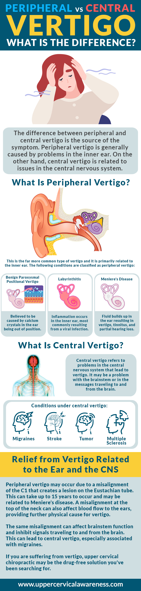 peripheral vertigo, central vertigo