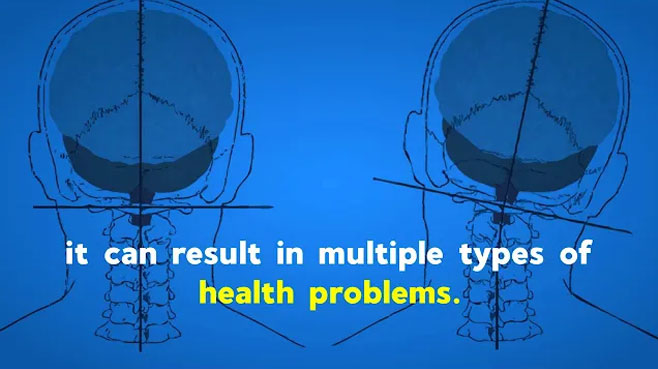 <!-- wp:paragraph -->
<p>Addressing Vertigo through Proper Spinal Alignment in Sioux Falls, SD.</p>
<!-- /wp:paragraph -->